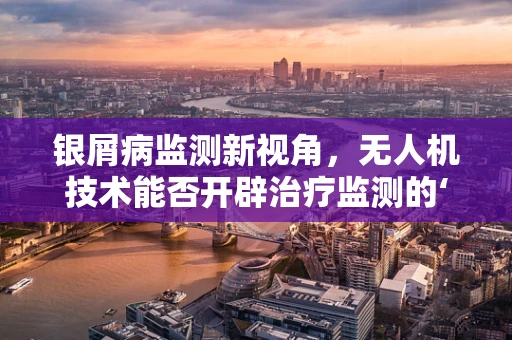 银屑病监测新视角，无人机技术能否开辟治疗监测的‘空中走廊’？
